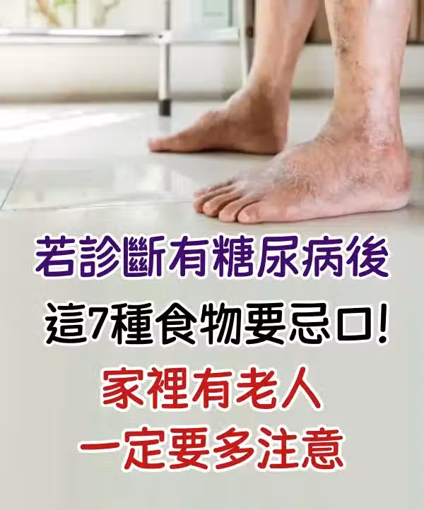 /www/bananadaily.net/web/images/image/2273/22736778.avif